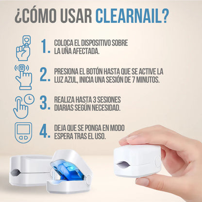 ClearNail Laser™ - Uñas sanas y fuertes desde la primera semana
