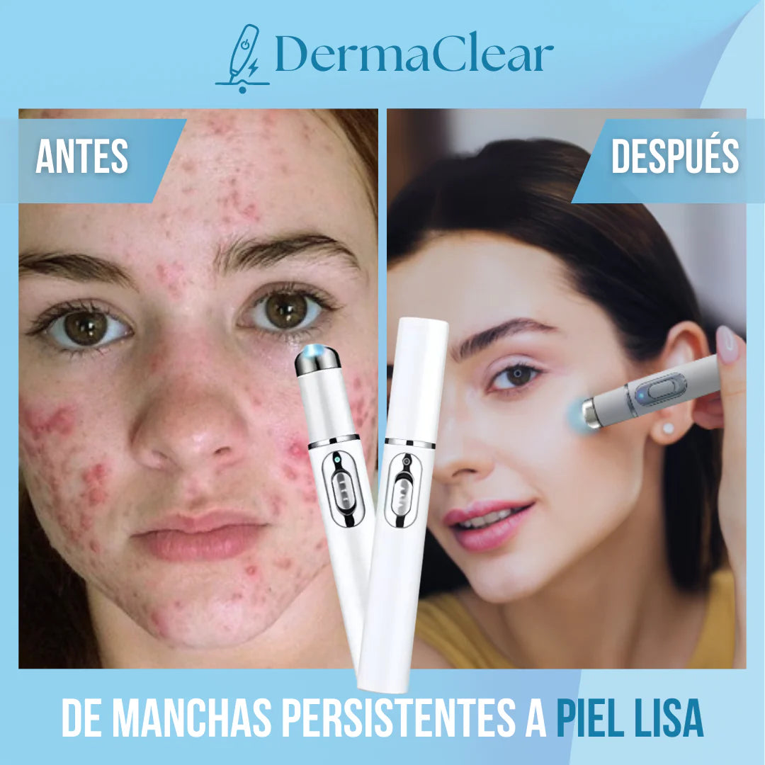 DermaClear™ – Borra imperfecciones al instante