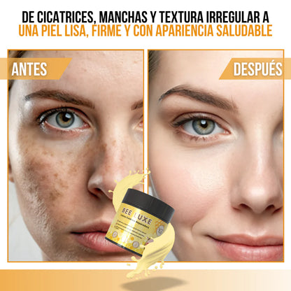 BeeLuxe™ - Restaura, reafirma y renueva tu piel con el poder natural del veneno de abeja.